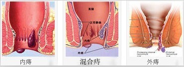 肛肠疾病有哪些科学的检查?